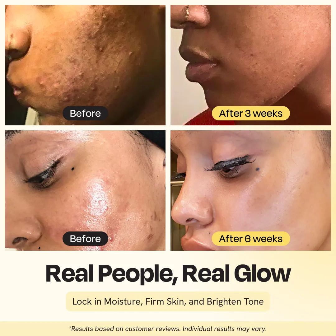 Supernutrient Face Oil – Anti-Aging Natural Oil for Glowing Skin